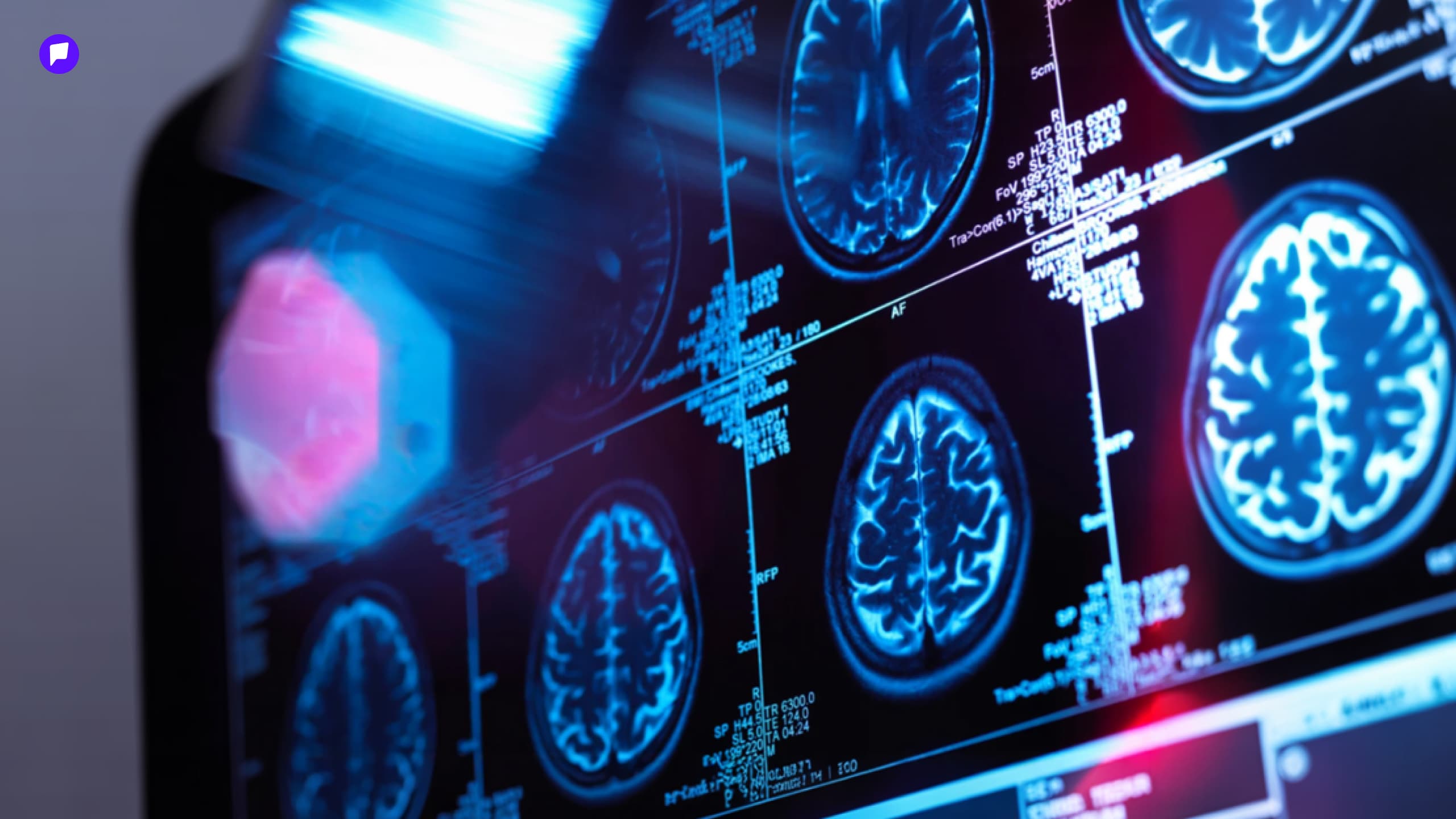 9, 32, 66 болон 83 насны үеүдэд тархинд хамгийн чухал өөрчлөлтүүд явагддаг - нийтлэлийн зураг