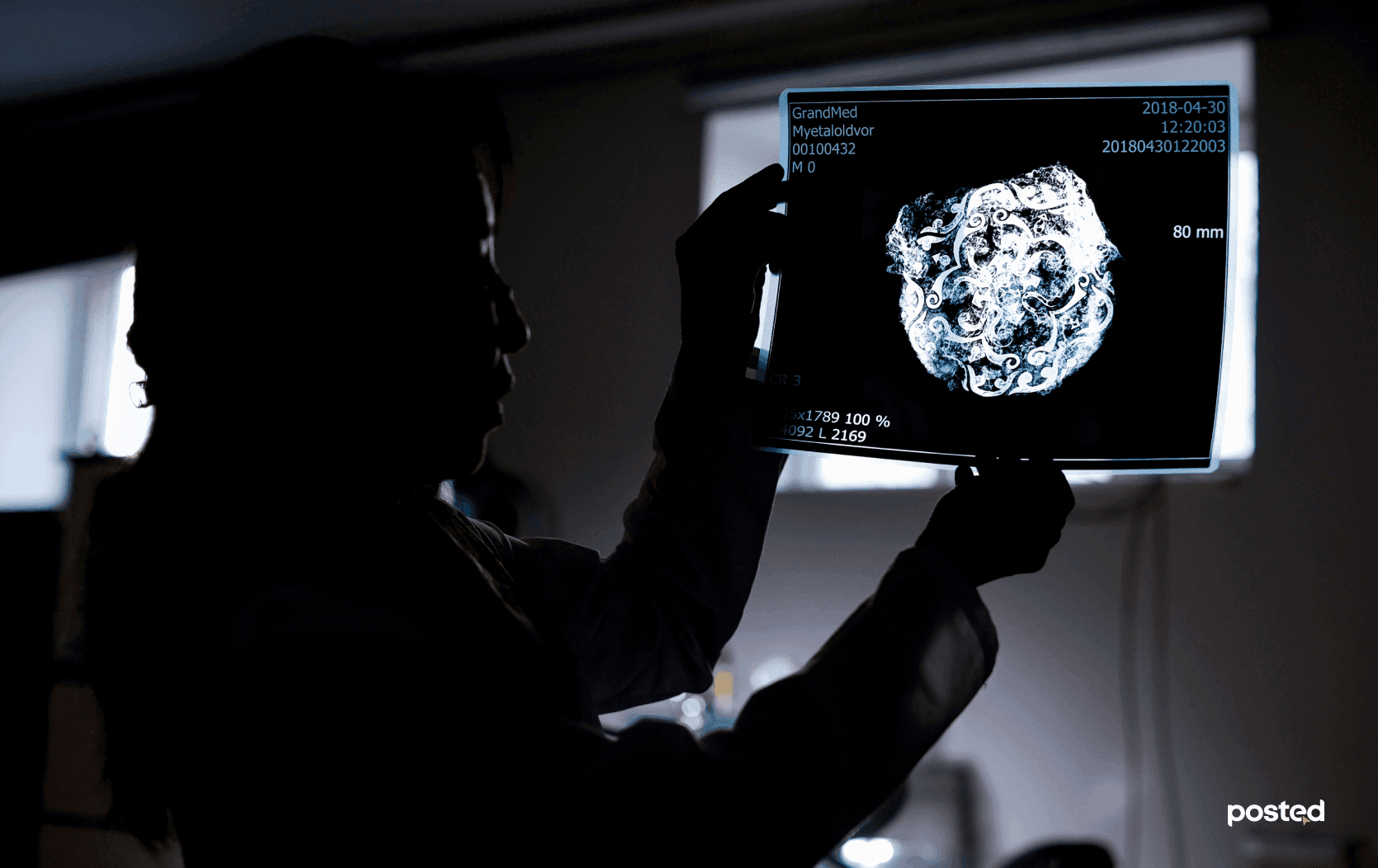 Р.ЭРДЭНЭЦЭЦЭГ: Археологийн олдворуудаа “аврах” үедээ л би хамгийн жаргалтай болдог нийтлэлийн зураг