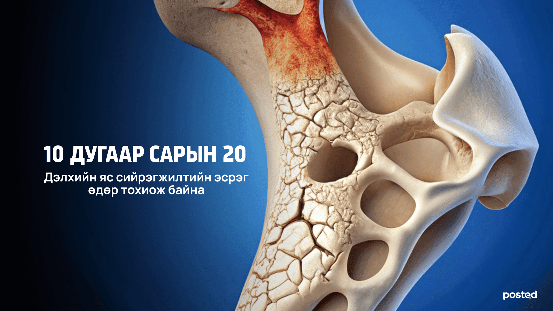Таны яс ярьж байна: Авраарай, сийрэгжих нь ээ!  - нийтлэлийн зураг